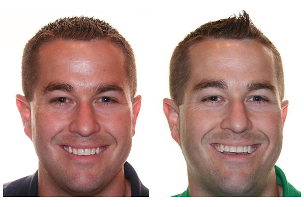 Herndon Dental Design