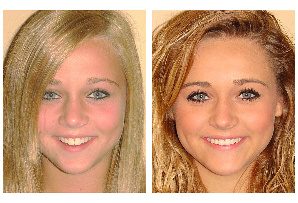 Herndon Dental Design